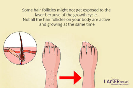 The-level-of-reduction The-level-of-reduction