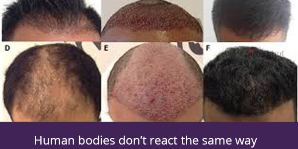 human-bodies human-bodies